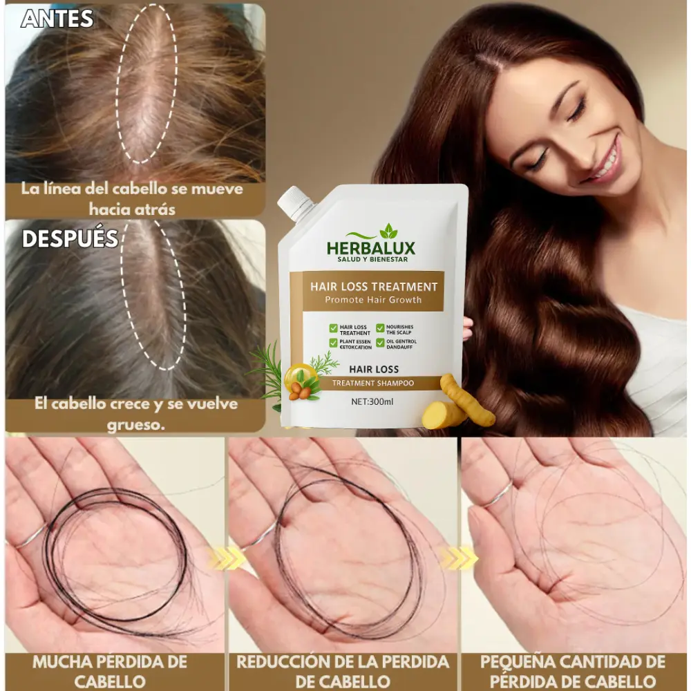 Anti-Hair Fall Shampoo - Anti-Caída y Reactivación Capilar HerbaLux