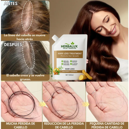 Anti-Hair Fall Shampoo - Anti-Caída y Reactivación Capilar HerbaLux