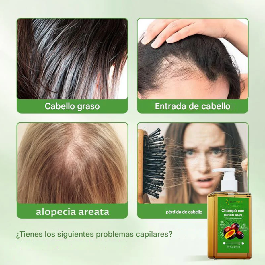 Shampoo BatanaPro™: La Fuerza que Tu Cabello Necesita HelixVital