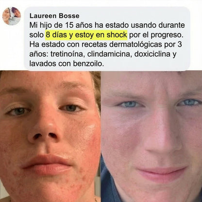 Bálsamo Batido de Sebo y Miel de Manuka (Whipped Tallow)