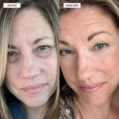 Crema Lifting TODO-EN-UNO para renovar el contorno de ojos