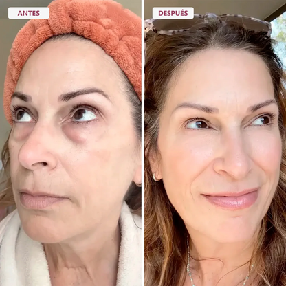 Crema Lifting TODO-EN-UNO para renovar el contorno de ojos