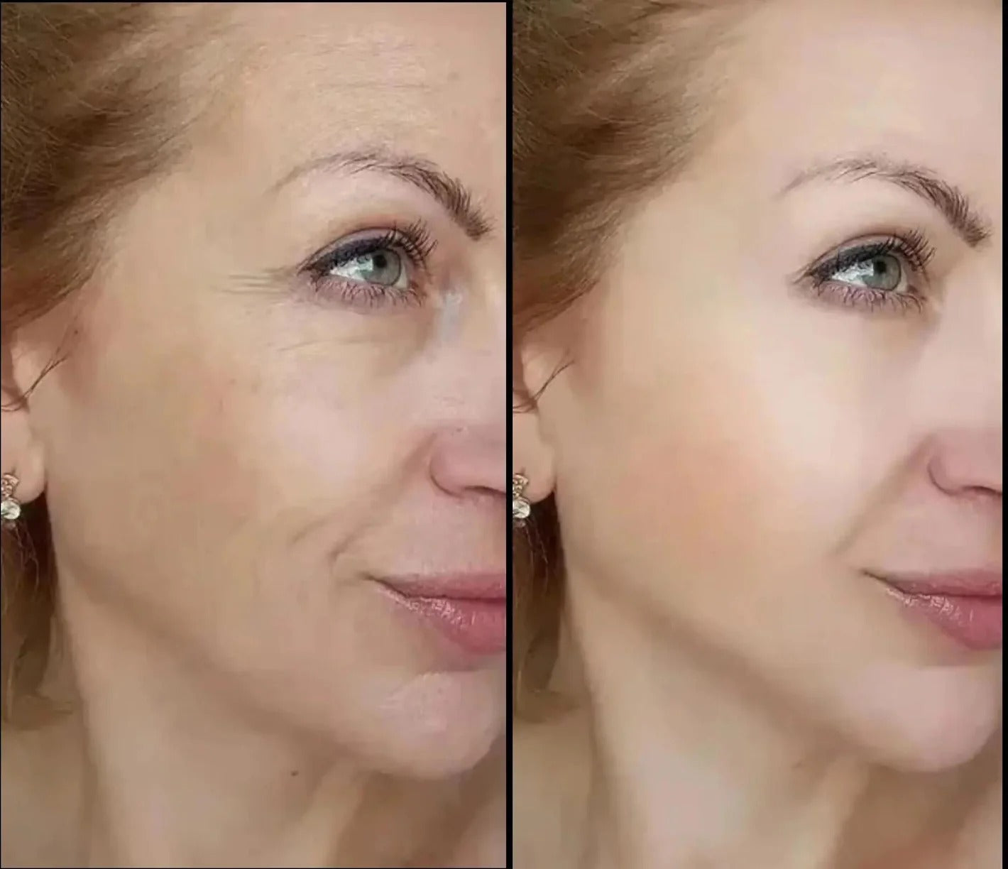 Crema Lifting - Gel tensor rejuvenecedor de ojos Herbalux Health