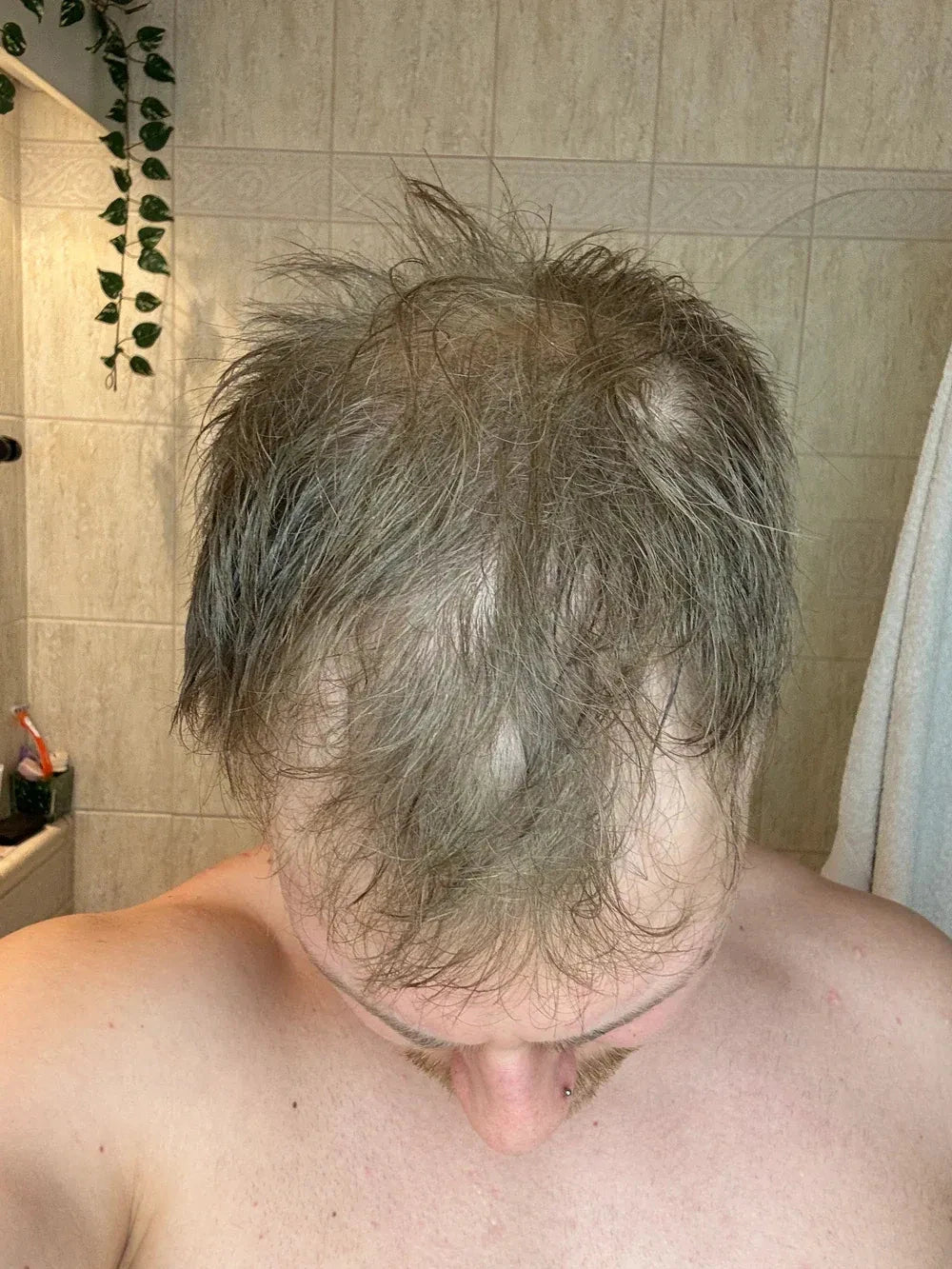 Hair Filler Density - Relleno para densidad capilar Herbalux Health