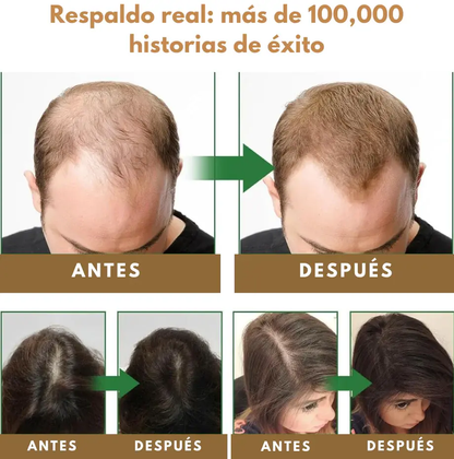 Anti-Hair Fall Shampoo - Anti-Caída y Reactivación Capilar HerbaLux