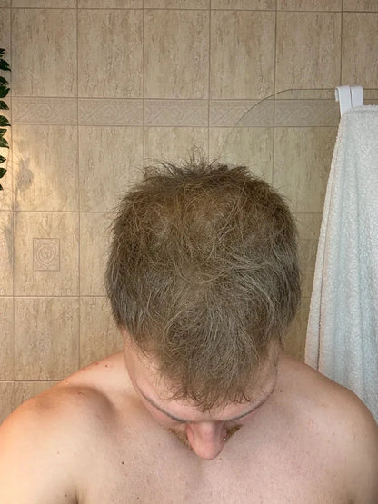 Hair Filler Density - Relleno para densidad capilar Herbalux Health