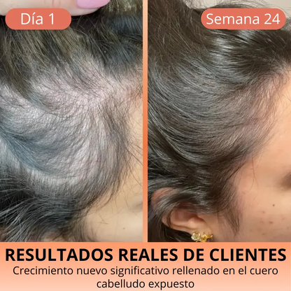 Aceite de Semilla de Calabaza 3000 mg – Cabello Fuerte y Piel Radiante HerbaLux