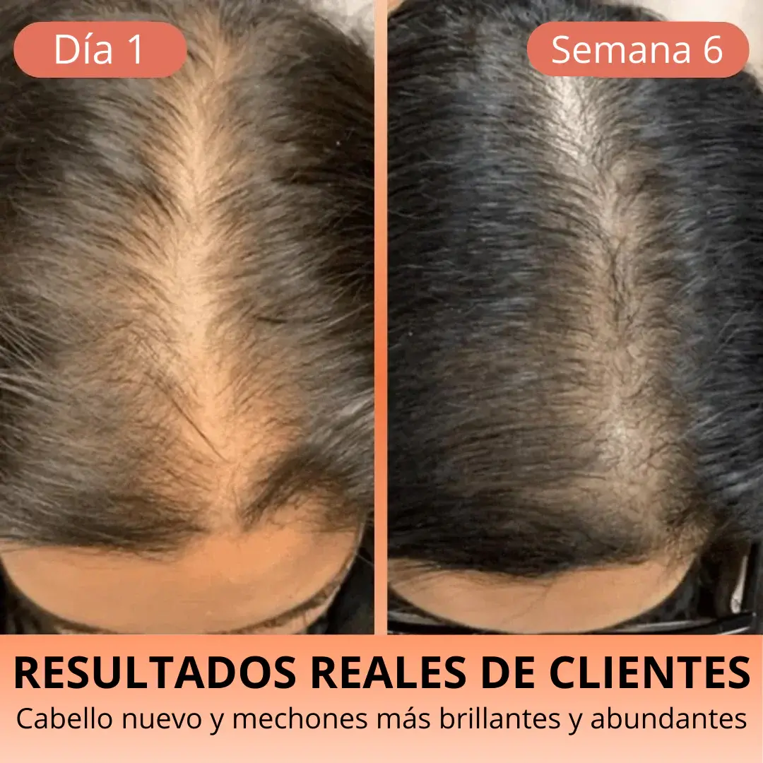 Aceite de Semilla de Calabaza 3000 mg – Cabello Fuerte y Piel Radiante HerbaLux