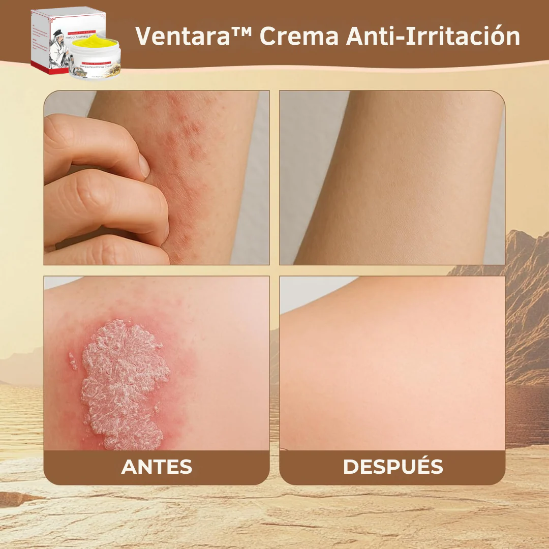 Crema Anti-Irritación - Herbalux Herbalux Health