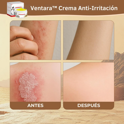 Crema Anti-Irritación - Herbalux Herbalux Health
