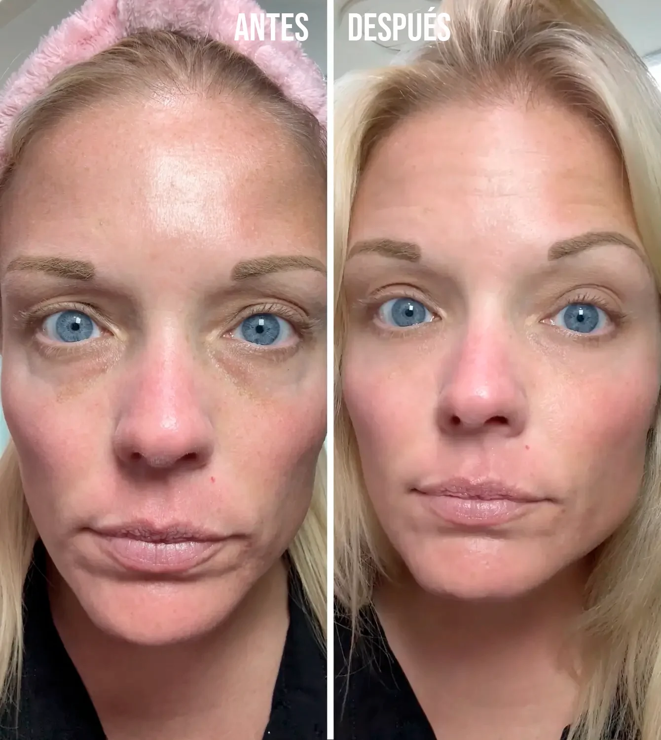 Crema Lifting TODO-EN-UNO para renovar el contorno de ojos