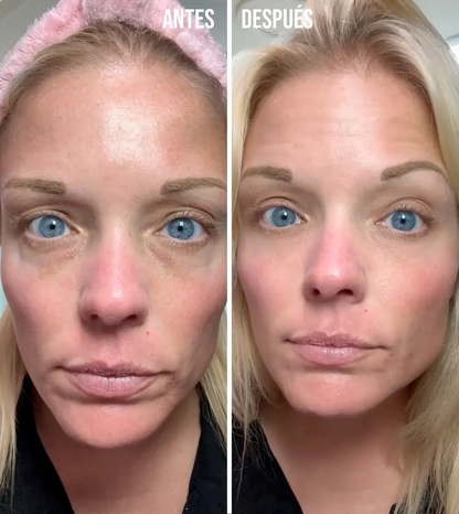 Crema Lifting TODO-EN-UNO para renovar el contorno de ojos